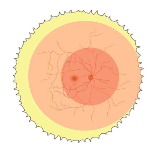 Retinopatia del prematuro